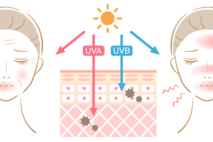 紫外線による肌ダメージ、UVA・UVB対策